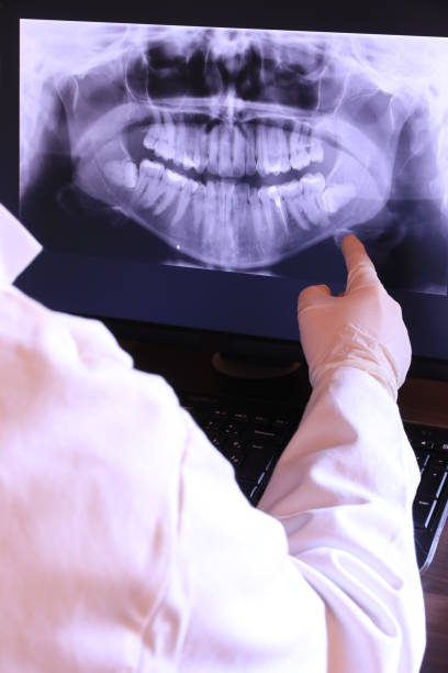 Best Emergency Dental Surgery in Wildwood, FL